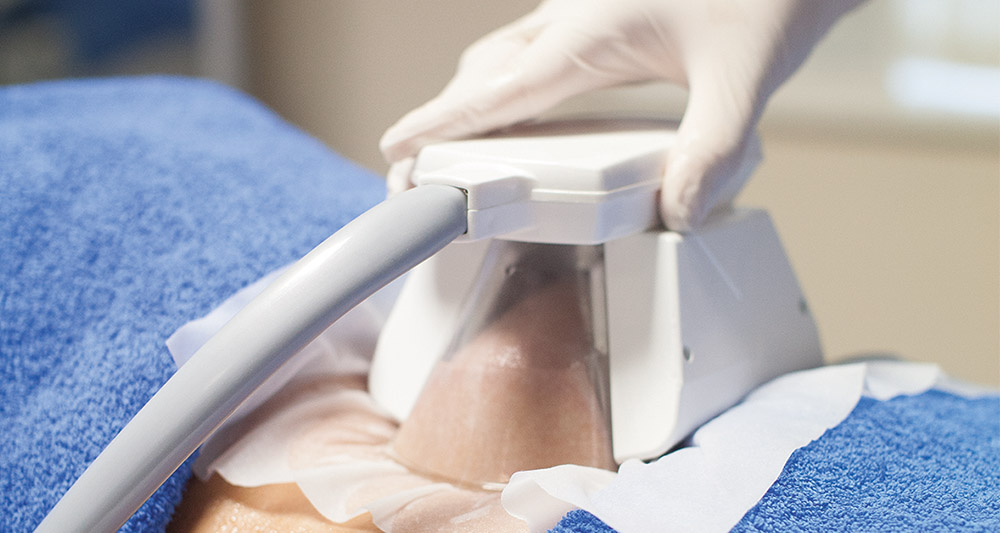 How Fat Freezing and HIFU Work Together? 2 Multiple Areas in One Session HIFU and Fat Freezing Billericay