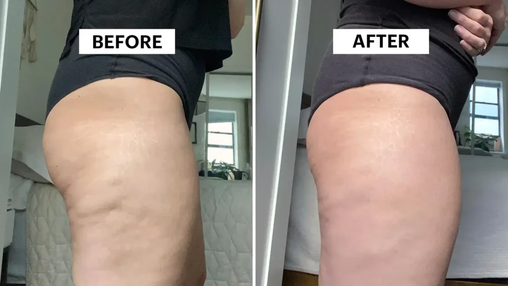 Do Toning Exercise Billericay Really Tackle Cellulite?