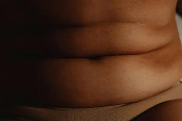 The Hidden Connection: How Stress Shapes Your Fitness and Body Composition 3 image of what stress can do on the stomach area and how Lipo 360 Billericay can help to change your body shape.