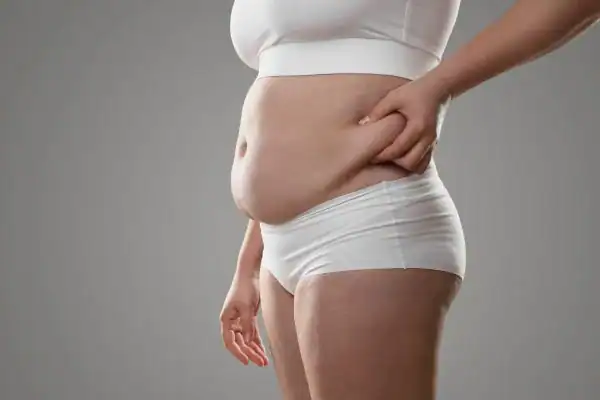 Image of stress belly Billericay How Lipo 360 can help manage your symptoms